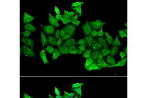Immunofluorescence analysis of MCF-7 cells using RHOH Polyclonal Antibody (RHOH anticorps)