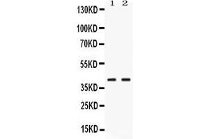 Western blot analysis of PSAT1 expression in rat pancreas extract ( Lane 1) and HELA whole cell lysates ( Lane 2). (PSAT1 anticorps  (AA 276-370))