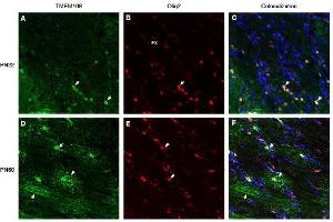 Immunohistochemical staining of perfusion-fixed frozen rat brain sections derived from post-natal day 22 (PN22) and from post-natal day 60 (PN60), using Anti-TMEM108 (extracellular) Antibody (ABIN7885615), followed by goat anti-rabbit- and Anti-OLIG2 Antibody, followed by goat anti-mouse-biotin and streptavidin-Cy3.