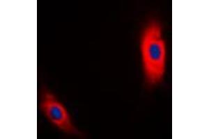 Immunofluorescent analysis of CK1 alpha staining in MCF7 cells.