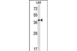 SPOPL Antibody (Center) (ABIN656695 and ABIN2845929) western blot analysis in uterus tumor cell line lysates (35 μg/lane). (SPOPL anticorps  (AA 221-249))