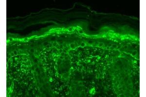 Immunohistochemistry analysis using Mouse Anti-TrpV3 Monoclonal Antibody, Clone S15-39 .