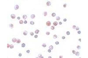 Immunohistochemistry (IHC) image for anti-Forkhead Box O1 (FOXO1) (N-Term) antibody (ABIN2473688) (FOXO1 anticorps  (N-Term))