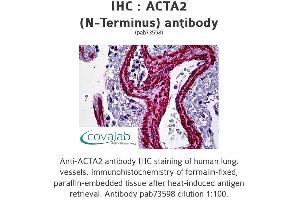 Image no. 1 for anti-Actin, alpha 2, Smooth Muscle, Aorta (ACTA2) (N-Term) antibody (ABIN1731469)