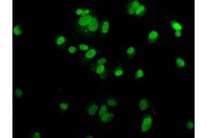 Immunofluorescence staining of MCF-7 cells with ABIN7150328 at 1:200, counter-stained with DAPI.