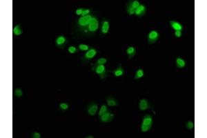 Immunofluorescence staining of MCF-7 cells with ABIN7150328 at 1:200, counter-stained with DAPI. (MCM2 anticorps  (AA 2-904))