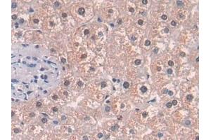 Detection of MAT2a in Human Liver Tissue using Polyclonal Antibody to Methionine Adenosyltransferase II Alpha (MAT2a)