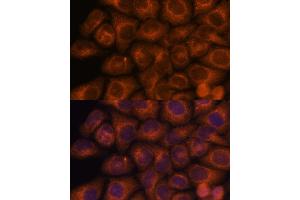 Immunofluorescence analysis of HeLa cells using SEC23IP antibody (ABIN7270170) at dilution of 1:100. (SEC23IP anticorps  (AA 600-940))