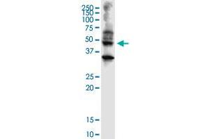 ABHD5 monoclonal antibody (M01), clone 1F3. (ABHD5 anticorps  (AA 1-349))