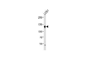 ECE2 Antibody (Center) (ABIN1881279 and ABIN2843411) western blot analysis in  cell line lysates (35 μg/lane). (ECE2 anticorps  (AA 551-579))