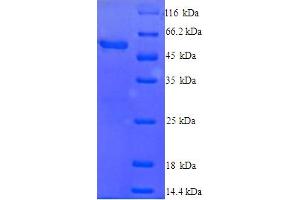SDS-PAGE (SDS) image for Cytochrome P450, Family 2, Subfamily E, Polypeptide 1 (CYP2E1) (AA 2-493) protein (His tag) (ABIN5713390)