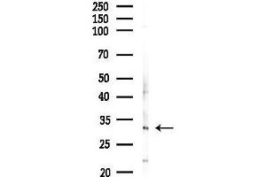 anti-Calponin (N-Term) antibody