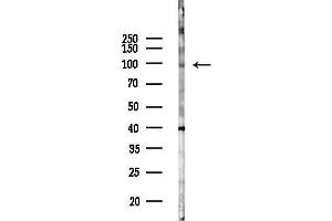 Western blot analysis of lysates from COLO205 cells(UV 30 min treatment), using INTS6L Antibody at 1/1000 dilution.