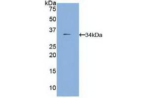 Western blot analysis of recombinant Mouse FUCa1. (FUCA1 anticorps  (AA 185-447))
