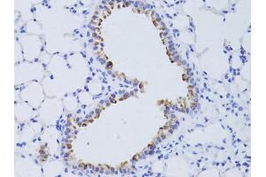 Immunohistochemistry of paraffin-embedded mouse lung using AQP4 antibody. (Aquaporin 4 anticorps)