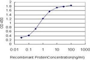 Detection limit for recombinant GST tagged PCAF is approximately 0. (KAT2B anticorps  (AA 353-452))