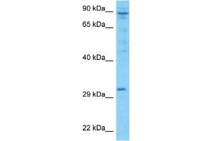 Host:  Rabbit  Target Name:  LRC52  Sample Type:  ACHN Whole Cell lysates  Antibody Dilution:  1. (LRRC52 anticorps  (Middle Region))