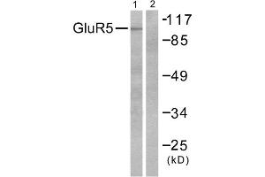 Western blot analysis of extracts from mouse brain, using GluR5 antibody (ABIN5976412). (GRIK1 anticorps  (N-Term))
