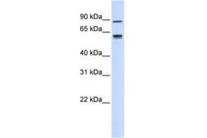 Image no. 1 for anti-Fibulin 3 (FBLN3) (C-Term) antibody (ABIN6743067) (FBLN3 anticorps  (C-Term))