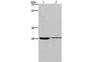 Western Blot analysis of 231 and Hela cell using CDK1 Polyclonal Antibody at dilution of 1:300 (CDK1 anticorps)