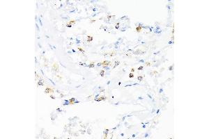 Immunohistochemistry of paraffin-embedded human lung using CAMP antibody (ABIN3022305, ABIN3022306, ABIN3022307, ABIN1512664 and ABIN6218724) at dilution of 1:200 (40x lens).