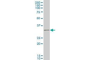 IBRDC2 monoclonal antibody (M02), clone 4F1 Western Blot analysis of IBRDC2 expression in IMR-32 .