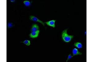 Immunofluorescence staining of MCF-7 cells with ABIN7161807 at 1:133, counter-stained with DAPI. (NUMA1 anticorps  (AA 627-870))