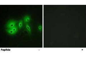 Immunofluorescence analysis of A-549 cells, using ADCY8 polyclonal antibody .