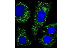 Fluorescent image of SK-BR-3 cells stained with ATP5B Antibody .