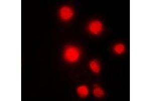 Immunofluorescent analysis of HMGB2 staining in Hela cells. (HMGB2 anticorps)