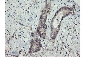 Image no. 6 for anti-ADP-Ribosylation Factor-Like 2 Binding Protein (ARL2BP) antibody (ABIN1496715)