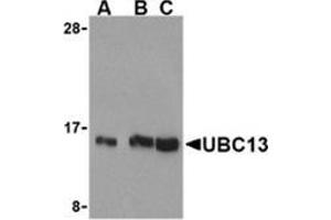 Western blot analysis of UBC13 in human small intestine cell lysates with this product at (A) 0. (UBE2N anticorps  (C-Term))