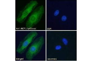 ABIN184583 Immunofluorescence analysis of paraformaldehyde fixed HeLa cells, permeabilized with 0.