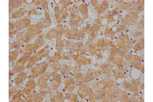 IHC image of ABIN7144415 diluted at 1:200 and staining in paraffin-embedded human liver tissue performed on a Leica BondTM system.