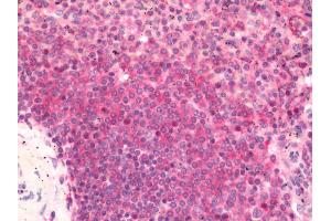 Human Spleen: Formalin-Fixed, Paraffin-Embedded (FFPE)