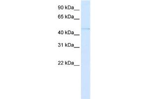 WB Suggested Anti-PAX3 Antibody Titration:  0. (Paired Box 3 anticorps  (C-Term))