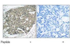 Image no. 1 for anti-V-Akt Murine Thymoma Viral Oncogene Homolog 1 (AKT1) (Thr308) antibody (ABIN197195) (AKT1 anticorps  (Thr308))
