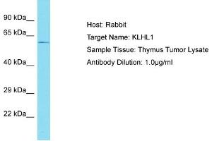 Host: Rabbit Target Name: KLHL1 Sample Tissue: Human Thymus Tumor Antibody Dilution: 1ug/ml (KLHL1 anticorps  (C-Term))