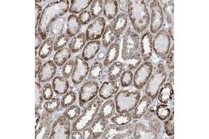 Immunohistochemical staining of human kidney with SLC7A4 polyclonal antibody  shows distinct cytoplasmic positivity with a granular pattern in tubular cells. (SLC7A4 anticorps)