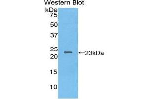 Detection of Recombinant NME3, Human using Polyclonal Antibody to Non Metastatic Cells 3, Protein NM23A Expressed In (NME3) (NME3 anticorps  (AA 1-168))