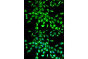 Immunofluorescence analysis of  cells using SERPIN antibody .
