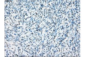 Immunohistochemical staining of paraffin-embedded colon tissue using anti-CRYABmouse monoclonal antibody. (CRYAB anticorps)