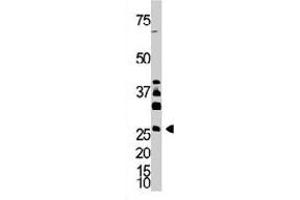 The DKK4 polyclonal antibody  is used in Western blot to detect DKK4 in A-375 cell lysate. (DKK4 anticorps  (AA 162-189))