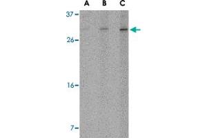 Western blot analysis of ORAI2 in Jurkat cell lysate with ORAI2 polyclonal antibody  at (A) 1, (B) 2 and (C) 4 ug/mL . (ORAI2 anticorps  (C-Term))