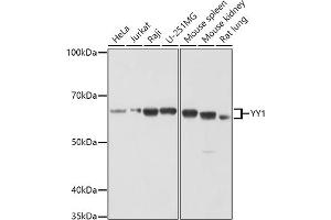 Western blot analysis of extracts of various cell lines, using YY1 antibody (ABIN6128933, ABIN6150354, ABIN6150356 and ABIN6216742) at 1:1000 dilution. (YY1 anticorps  (AA 1-200))