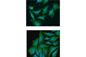 ICC/IF analysis of TBCA in A549 cells line, stained with DAPI (Blue) for nucleus staining and monoclonal anti-human TBCA antibody (1:100) with goat anti-mouse IgG-Alexa fluor 488 conjugate (Green).
