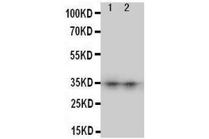 Anti-Aquaporin 8 antibody, Western blotting Lane 1: SW620 Cell Lysate Lane 2: COLO320 Cell Lysate (Aquaporin 8 anticorps  (N-Term))