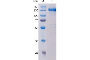 Human Protein, hFc Tag on SDS-PAGE under reducing condition.