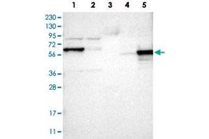 Western Blot analysis of Lane 1: RT-4 cell, Lane 2: U-251 MG sp cell, Lane 3: human plasma tissue (IgG/HSA depleted), Lane 4: human liver tissue and Lane 5: human tonsil tissue lysates with ICA1 polyclonal antibody . (ICA1 anticorps)
