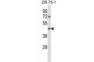 Western Blotting (WB) image for anti-Olfactory Receptor, Family 2, Subfamily T, Member 6 (OR2T6) antibody (ABIN2998458) (OR2T6 anticorps)